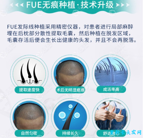 FUE-APL2.0无痕植发技术