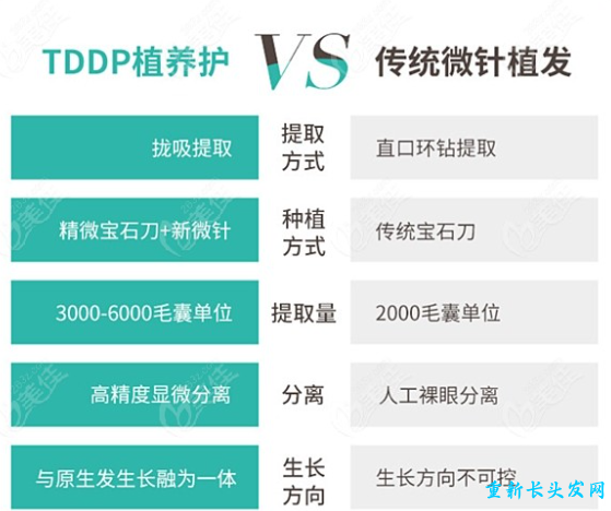 TDDP植发技术